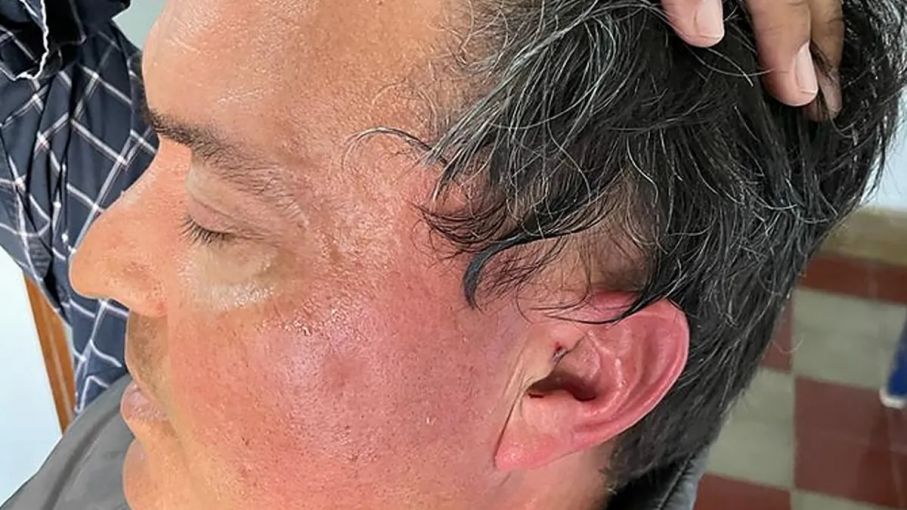 Un jefe de una comunal de Santa Fe agredió a un productor que es cuñado de José Luis Espert