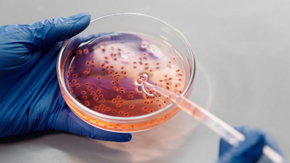 Bioceres logra aprobacin en Brasil y suben sus acciones en Wall Street