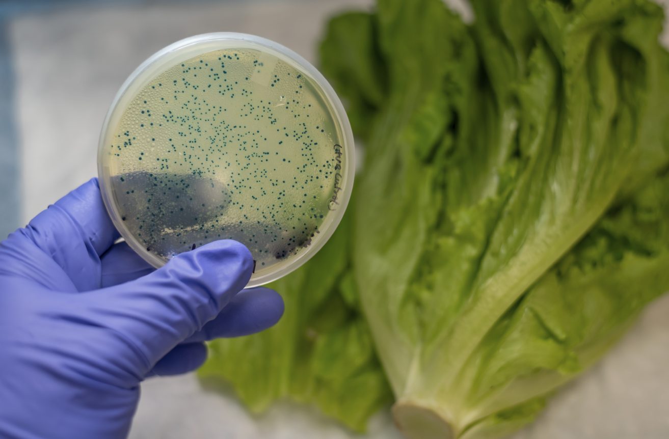 Alerta sanitaria por verduras contaminadas: detectan parásitos intestinales en productos del cinturón hortícola bonaerense