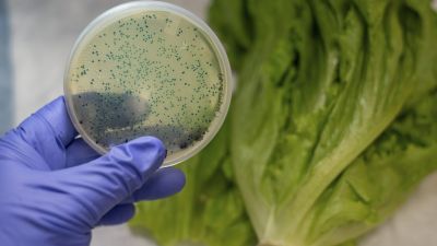 Alerta sanitaria por verduras contaminadas: detectan parásitos intestinales en productos del cinturón hortícola bonaerense